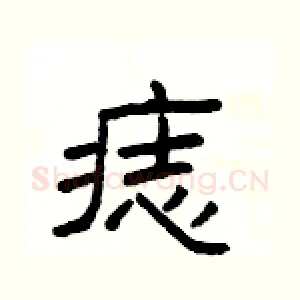 痣